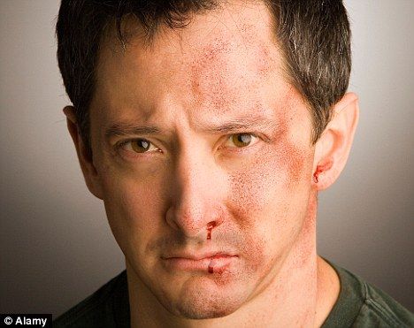 INTIMATE PARTNER VIOLENCE 38